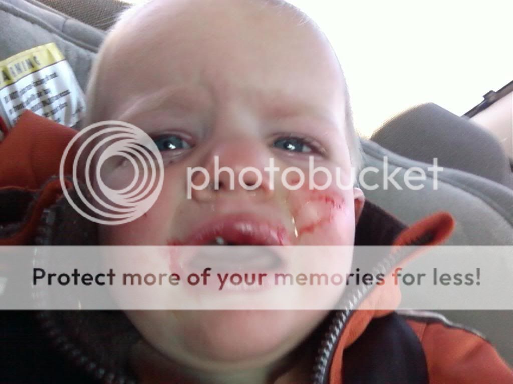 Baby fell. Suggestions? BabyCenter